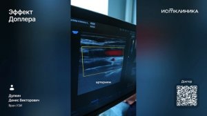 Эффект Доплера