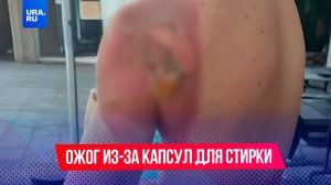 Мужчина получил ожог из-за капсул для стирки