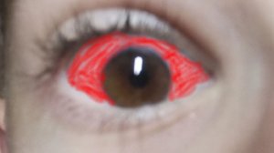 No.i not a human 4 часть