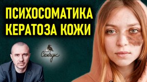 Как кератоз связан со старыми друзьями. Как вернуть коже здоровый вид. Феноменальная психосоматика