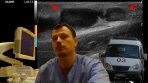 Детское УЗИ мягких тканей - Деструкция бедренных лимфатических узлов