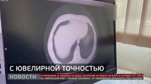 Уникальная операция: бойцу удалили осколок у сердца. Новости. 13/11/2025. GuberniaTV