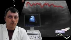 Детское УЗИ мягких тканей - "Мохнатое" образование подмышечной области