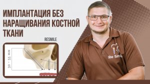 Всё о скуловой имплантации: технология и преимущества ❘ Клиника ReSmile