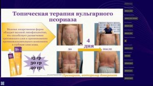 Псориаз и дерматозы с нарушением пролиферации кератиноцитов. Диалог дерматовенеролога и ревматолога