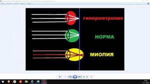 Какое бывает ЗРЕНИЕ!! Как ая НОРМА!!!