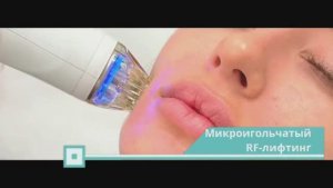 Микроигольчатый RF-лифтинг