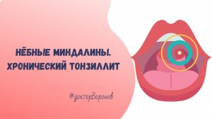 Нëбные миндалины. Хронический тонзиллит