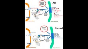 Боковой амиотрофический склеро (БАС) - плата за эволюцию бегунов марафонцев