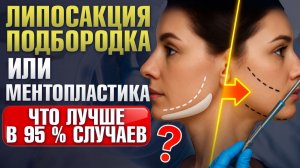 Ментопластика или липосакция подбородка? / Установка полиуретанового имплантата в подбородок