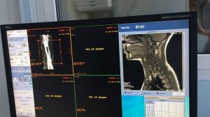 Реконструкция артерий шеи  на МРТ: настройка параметров  постобработки