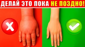 СПАСАЕМ РУКИ ОТ ОТЕКОВ! | Убираем ЗАСТОЙ крови простой гимнастикой!