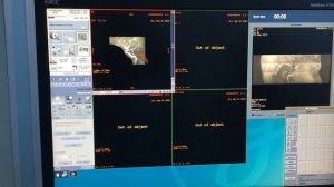 Реконструкция и ротация артерий головного мозга на МРТ: методы визуализации и обработка данных