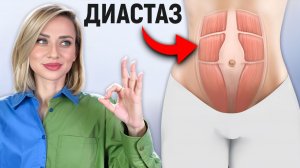 ДИАСТАЗ. Как собрать живот, если он провисает и расходится?