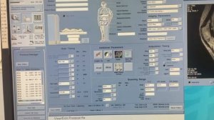 Мультифазная серия при контрастировании брюшной полости: работа с временными промежутками