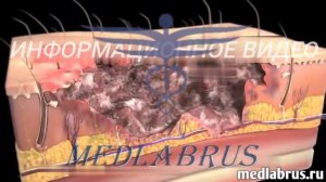 Хирургическая обработка ран: показания, методика и уход