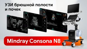 УЗИ брюшной полости и почек: Mindray Consona N8 в реальной работе