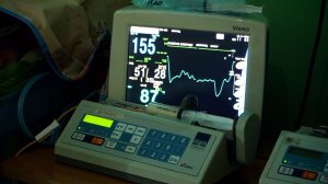 ТЕПЛО ДЛЯ САМЫХ МАЛЕНЬКИХ