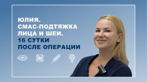 Юлия. СМАС-подтяжка лица и шеи. 16 сутки после операции