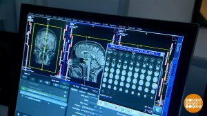 Мозг никогда не спит! Доброе утро. Фрагмент выпуска от 17.11.2025