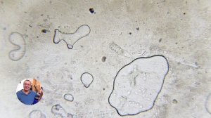 Убьёт ли нашатырный спирт 0,2% клеща Демодекс?  Эксперимент под микроскопом