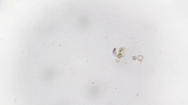 Гвоздика против демодекса - Убьёт ли специя клещей? смотреть онлайн