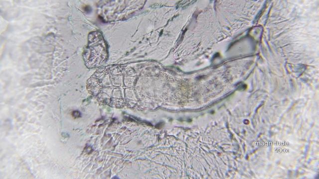 Хозяйственное мыло против Демодекса – выживет ли клещ? смотреть онлайн
