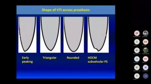 Assessment of the Prosthetic Valves на русском