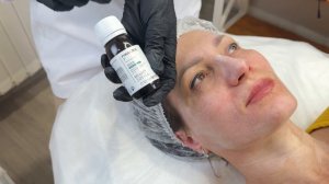 💧 Пировиноградный пилинг поверх салицилового — как работать?