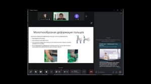 18.11 | Врач-ортопед: Венер Валиев | Деформации пальцев стопы: что нужно знать подологу