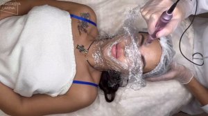 ⚡️ Микронидлинг