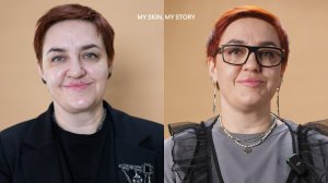 BABOR_MY SKIN, MY STORY: Уход при сухости, пигментации и отёчности — Екатерина