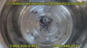 Отливка женских новообразований