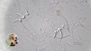 Что чеснок делает с микробами под микроскопом  Мгновенная смерть!