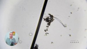 7-месячный отвар гвоздики уничтожил ВСЕХ микробов!  Реальный эксперимент