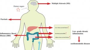 Чрезмерное потребление сахара: соучастник воспаления