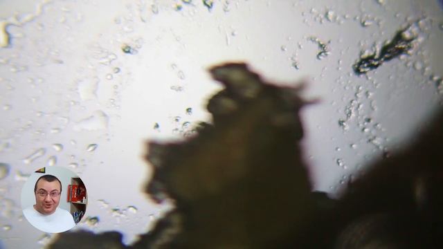 Демодекс под микроскопом — Звёздочка против клеща! Как убить демодекса? Реальный эксперимент! смотреть онлайн