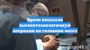 Врачи показали высокотехнологичную операцию на головном мозге