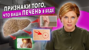 8 КРИТИЧЕСКИХ ПРИЗНАКОВ ПРОБЛЕМ С ПЕЧЕНЬЮ : #докторЩербатова