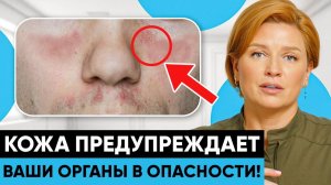 ВЫ ДОЛЖНЫ ЭТО ЗНАТЬ! Кожа указывает на проблемы внутри!