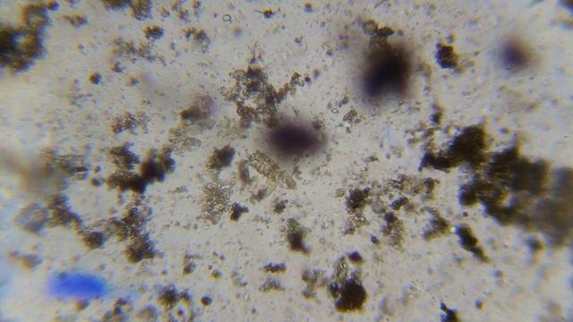 Купаю клеща демодекс в стиральном порошке – эксперимент под микроскопом! смотреть онлайн