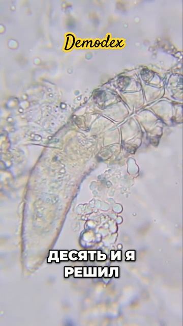 Клещ под микроскопом новые друзья и аксессуары! смотреть онлайн