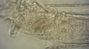 Коловратка (лат. Rotifera)