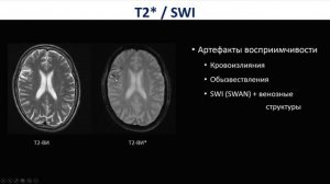 Базовый курс по МРТ. Импульсные последовательности,в исследованиях головного мозга.Трофименко И.А.2