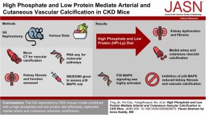 Артерии как камень: высокий уровень фосфата, низкий уровень белка способствуют кальцификации артерий