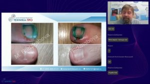 Кристалл. Онлайн семинар по аппаратам лазерной косметологии