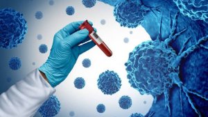 САМЫЙ ПОЗНАВАТЕЛЬНЫЙ КАНАЛ. ВСЁ О РАКЕ ПРОСТАТЫ.