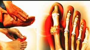 Исцеление Подагры и Артрита  Звуком*Частотная Терапия