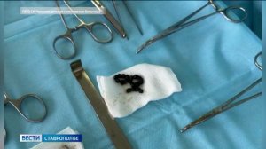 На Ставрополье врачи извлекли из желудка мальчика 18 магнитов
