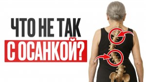 СТРАШНЫЕ последствия СКОЛИОЗА! / Откуда он берется и как помочь себе самостоятельно?